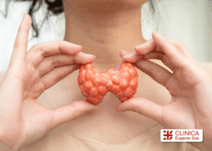 cancer de tiroides