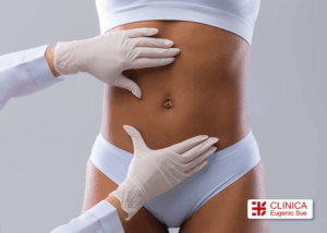 abdominoplastia todo lo que debes saber